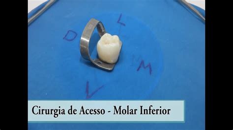 1° ACESSO CANAL .